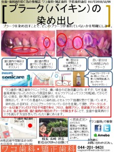 わ　ワコ歯科・矯正歯科通信　011　ぷ　プラーク（バイキン）の染め出し　2015-1210